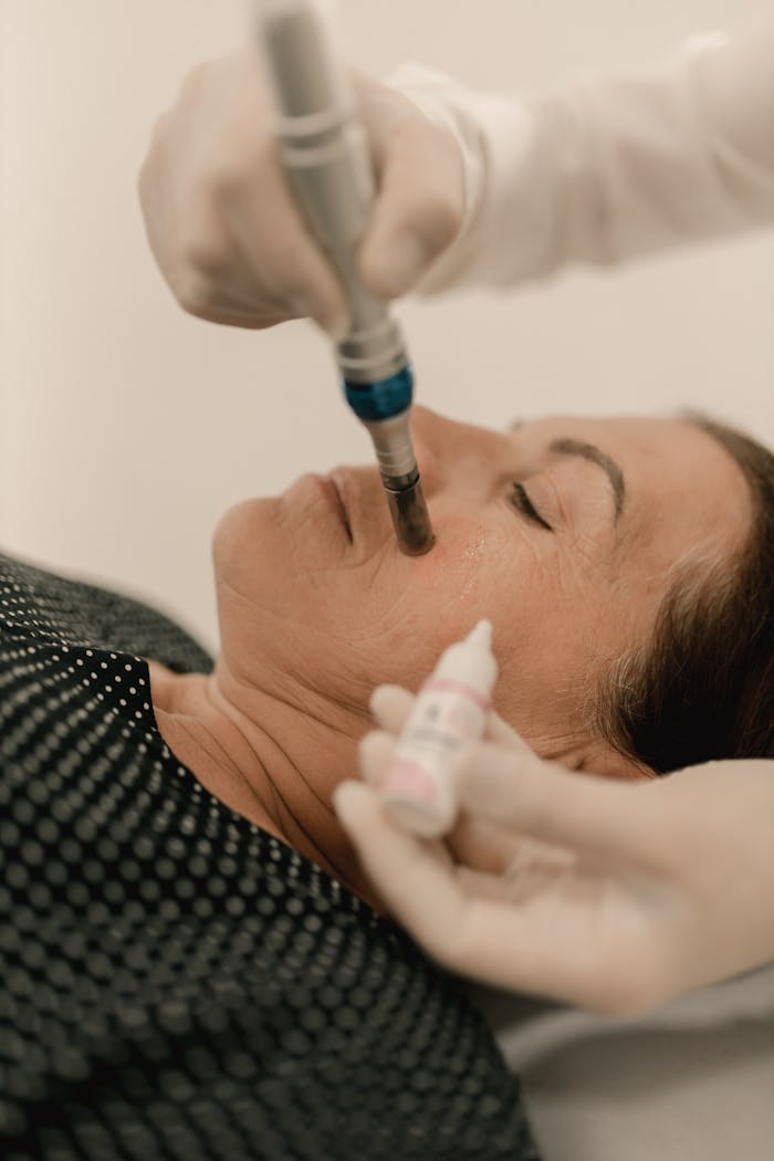 A woman receiving a facial microdermabrasion treatment in a spa setting.